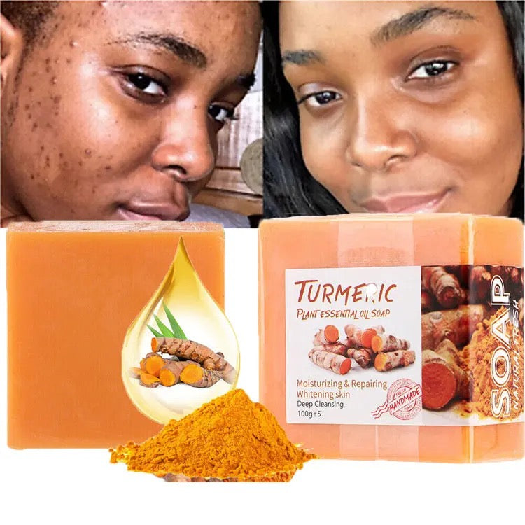 Turmeric Essential Oil Soap for Face and Body (2-pack)